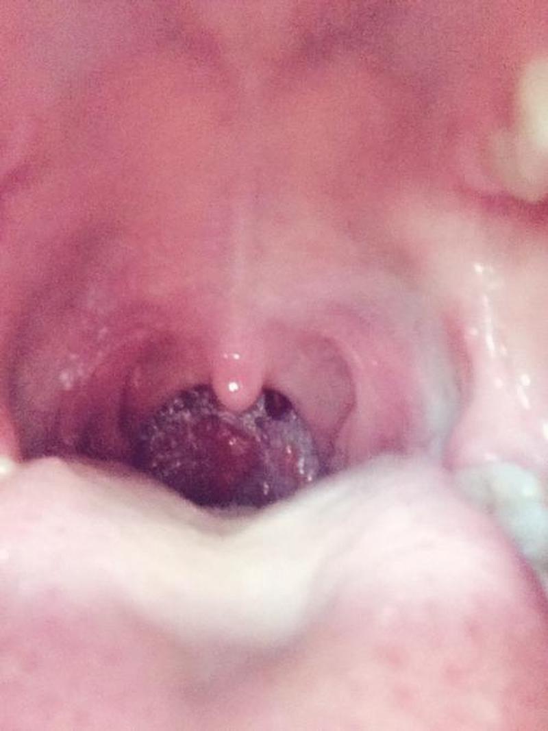 咽喉 喉咙 嗓子
